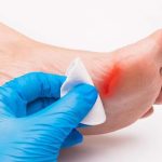 Diabetic Patient: డయాబెటిస్ ఉన్న వారిలో.. గాయాలు త్వరగా ఎందుకు మానవు ?