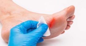 Diabetic Patient: డయాబెటిస్ ఉన్న వారిలో.. గాయాలు త్వరగా ఎందుకు మానవు ?