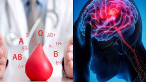 Blood Group: మీ బ్లడ్ గ్రూప్ ఇదేనా? జాగ్రత్తగా ఉండండి, బ్రెయిన్ స్ట్రోక్ వస్తుందట.. ఇలా చేస్తే సేఫ్!