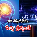 New depression cure 2025: డిప్రెషన్ అని వెళ్తే.. డాక్టర్లు ఇక ‘షాక్’ ఇస్తారు.. హైదరాబాద్ పరిశోధకుల తాజా స్టడి సక్సెస్!
