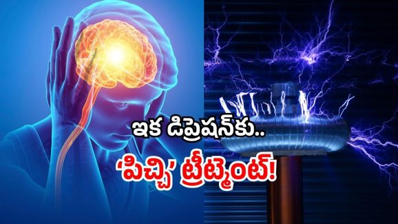 New depression cure 2025: డిప్రెషన్ అని వెళ్తే.. డాక్టర్లు ఇక ‘షాక్’ ఇస్తారు.. హైదరాబాద్ పరిశోధకుల తాజా స్టడి సక్సెస్!