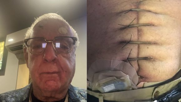 WWE Ric Flair : ప్రమాదంలో  WWE స్టార్ రిక్ ఫ్లెయర్… కడుపులో ఏకంగా 10 కుట్లు !