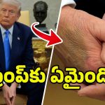 Donald Trump Health: ఆ వ్యాధితో బాధపడుతున్న ట్రంప్.. వైట్‌హౌజ్ కీలక ప్రకటన