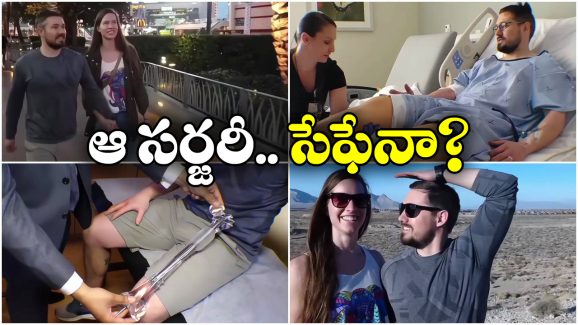 Viral News: భార్య కంటే ఎత్తు కనిపించాలని సర్జరీ, అవసరమా బ్రో!