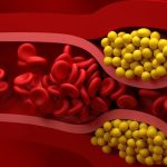 Bad cholesterol: ఖాళీ పొట్టతో ఈ డ్రింక్ తాగండి చాలు, సిరల్లో పేరుకుపోయిన కొలెస్ట్రాల్ మొత్తం కొట్టుకుపోతుంది
