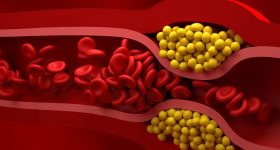 Bad cholesterol: ఖాళీ పొట్టతో ఈ డ్రింక్ తాగండి చాలు, సిరల్లో పేరుకుపోయిన కొలెస్ట్రాల్ మొత్తం కొట్టుకుపోతుంది