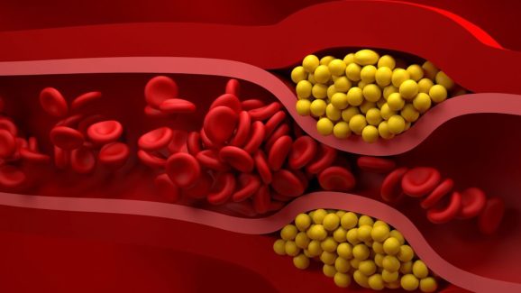 Bad cholesterol: ఖాళీ పొట్టతో ఈ డ్రింక్ తాగండి చాలు, సిరల్లో పేరుకుపోయిన కొలెస్ట్రాల్ మొత్తం కొట్టుకుపోతుంది