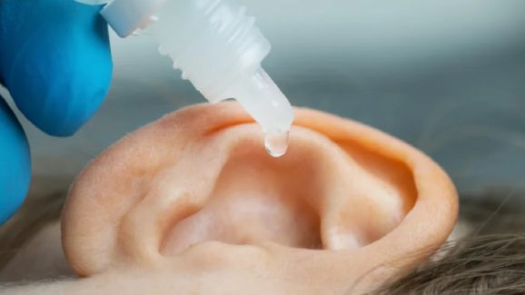 Earwax: చెవిలో గులిమితో ఇబ్బంది పడుతున్నారా ? ఇలా చేస్తే గులిమి మొత్తం బయటికి వచ్చేస్తుంది