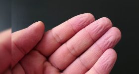 Hand Wrinkles: నీటిలో చేతులు పెడితే.. ఎందుకు ముడతలు పడతాయి? ఏంటా సీక్రెట్?
