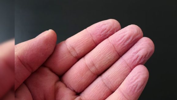Hand Wrinkles: నీటిలో చేతులు పెడితే.. ఎందుకు ముడతలు పడతాయి? ఏంటా సీక్రెట్?