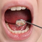 Oral cancer: జాగ్రత్త! నోటి ఆరోగ్యం సరిగ్గా లేకపోవడం వల్ల కూడా క్యాన్సర్ వస్తుందట..