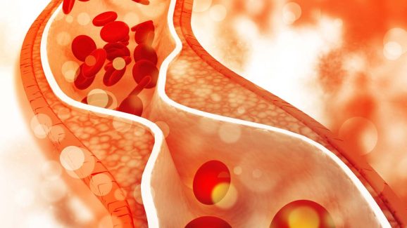 Cholesterol: కొలెస్ట్రాల్ కంట్రోల్ కోసం.. ఎలాంటి టిప్స్ పాటించాలి ?
