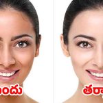 Skin Whitening Tips: ఛాలెంజ్, ఈ టిప్స్ పాటిస్తే.. 7 రోజుల్లోనే నిగనిగలాడే చర్మం
