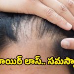 Hair Loss: ఈ విటమిన్ లోపమే.. జుట్టు రాలడానికి కారణమట !
