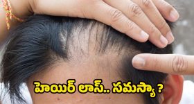 Hair Loss: ఈ విటమిన్ లోపమే.. జుట్టు రాలడానికి కారణమట !