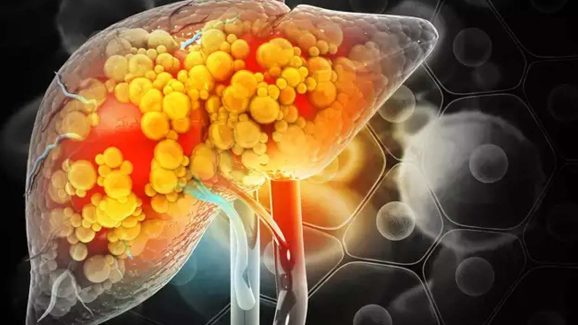 Liver Health: మీరు చేసే ఈ పొరపాట్లే.. లివర్ డ్యామేజ్‌కి కారణం !