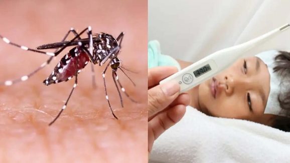 Dengue Fever: వర్షాకాలంలో జ్వరమా ? డెంగ్యూ కావొచ్చు !