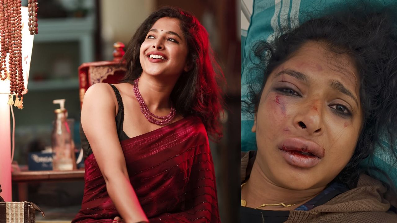 Dhee Bhoomika : ఢీ కంటెస్టెంట్ కి భారీ యాక్సిడెంట్… కారు తుక్కు తుక్కు