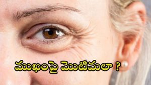 Wrinkles: చిన్న వయస్సులోనే.. ముఖంపై ముడతలా ? ఈ టిప్స్ పాటించండి !