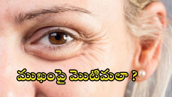 Wrinkles: చిన్న వయస్సులోనే.. ముఖంపై ముడతలా ? ఈ టిప్స్ పాటించండి !