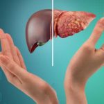 Fatty Liver Disease: మహిళలకు ఫ్యాటీ లివర్ ముప్పు.. ఈ లక్షణాలను అస్సలు లైట్ తీసుకోవద్దు