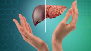 Fatty Liver Disease: మహిళలకు ఫ్యాటీ లివర్ ముప్పు.. ఈ లక్షణాలను అస్సలు లైట్ తీసుకోవద్దు