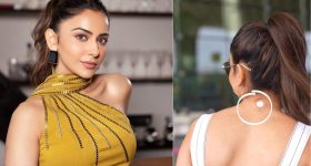 Rakul Preet Singh: అయ్యో.. రకుల్ కి ఏమైంది.. మెడపై ఆ స్టిక్కర్ ఏంటి?