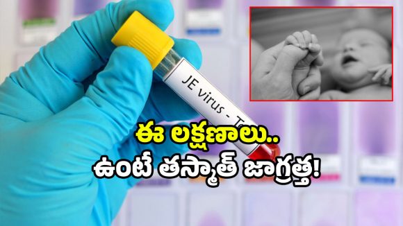 Rare disease: హడలెత్తిస్తున్న అరుదైన వ్యాధి.. పాపం చిన్నారి మృతి.. బీ అలర్ట్!
