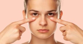 Dark Circles: డార్క్ సర్కిల్స్ తగ్గించే.. బెస్ట్ టిప్స్ ఇవే !