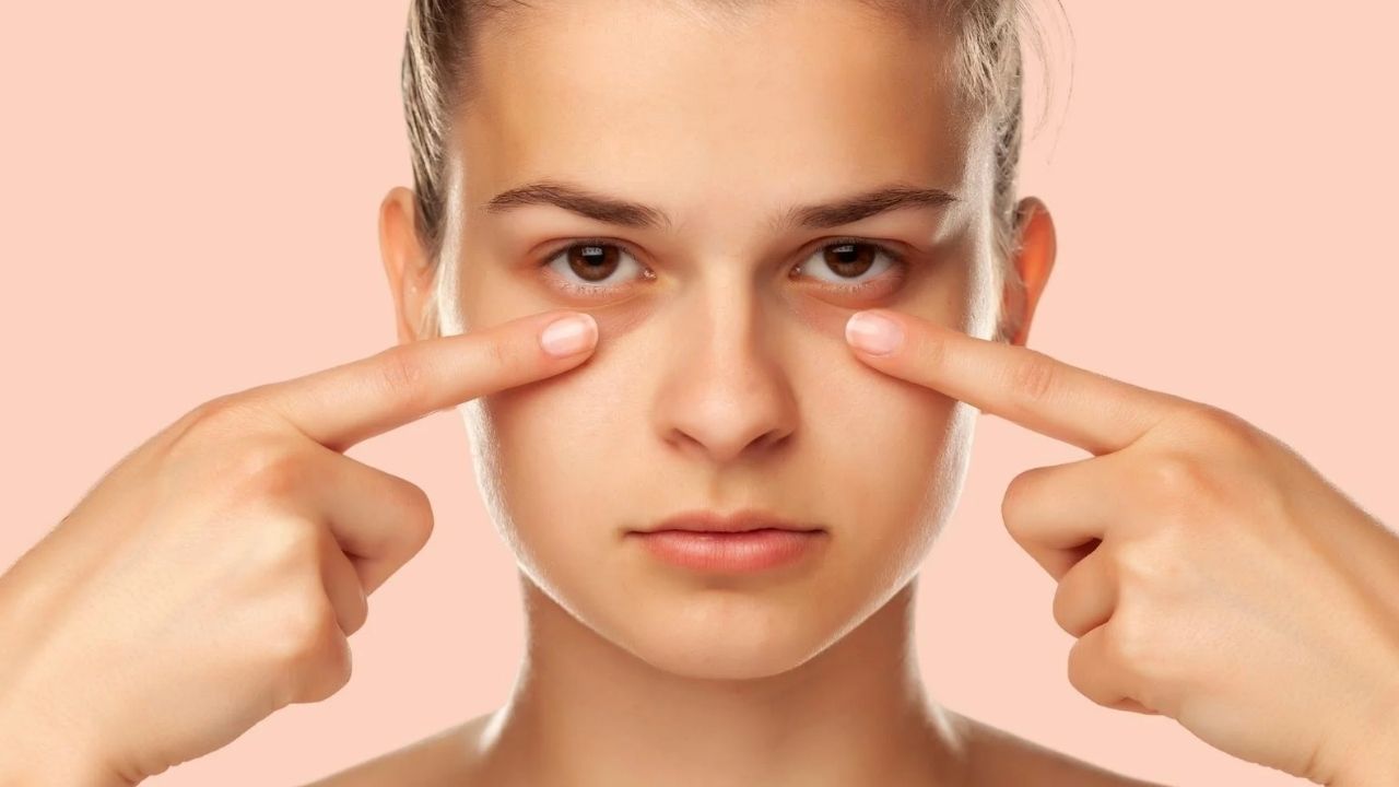 Dark Circles: డార్క్ సర్కిల్స్ తగ్గించే.. బెస్ట్ టిప్స్ ఇవే !