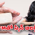 TFM – Skin: TFM అంటే ఏమిటి? దీని వల్ల స్కిన్ సమస్యలు ఎలా వస్తాయో తెలుసా?