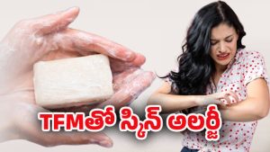 TFM – Skin: TFM అంటే ఏమిటి? దీని వల్ల స్కిన్ సమస్యలు ఎలా వస్తాయో తెలుసా?