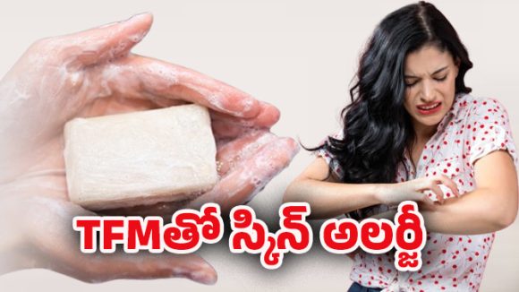 TFM – Skin: TFM అంటే ఏమిటి? దీని వల్ల స్కిన్ సమస్యలు ఎలా వస్తాయో తెలుసా?