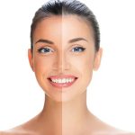 Tan Removal Tips: ముఖం నల్లగా మారిందా ? ఇలా చేస్తే.. క్షణాల్లోనే గ్లోయింగ్ స్కిన్