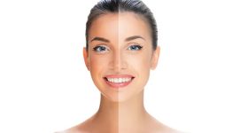Tan Removal Tips: ముఖం నల్లగా మారిందా ? ఇలా చేస్తే.. క్షణాల్లోనే గ్లోయింగ్ స్కిన్