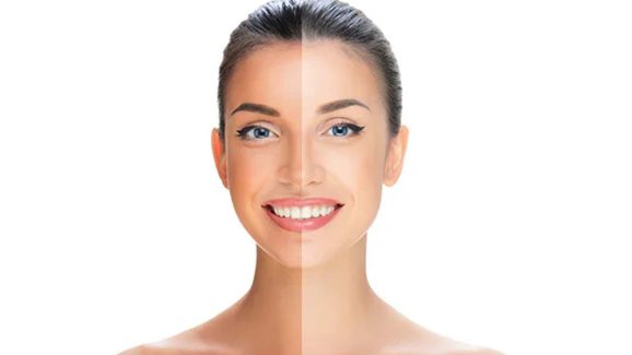 Tan Removal Tips: ముఖం నల్లగా మారిందా ? ఇలా చేస్తే.. క్షణాల్లోనే గ్లోయింగ్ స్కిన్