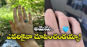 Hair Fall: ఈ టిప్స్ పాటిస్తే.. జుట్టు ఊడమన్నా ఊడదు !