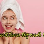 Pimple Removal Tips: మొటిమలు తగ్గాలంటే ఎలాంటి టిప్స్ పాటించాలి ?