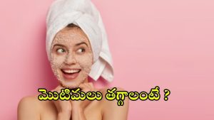 Pimple Removal Tips: మొటిమలు తగ్గాలంటే ఎలాంటి టిప్స్ పాటించాలి ?