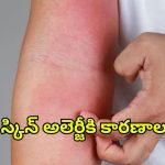 Skin Allergy: స్కిన్ అలెర్జీకి కారణాలివేనట !