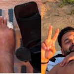 Rishabh Pant : రిషబ్ పంత్ విరిగిన కాలి వేళ్ళు.. ఫోటో వైరల్..