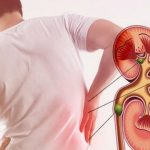 Kidney Stones: కిడ్నీ స్టోన్స్ సమస్యా ? ఇవి తింటే.. ప్రాబ్లమ్ సాల్వ్