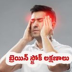 Warning Signs of Stroke: బ్రెయిన్ స్ట్రోక్.. ప్రారంభ లక్షణాలు ఎలా ఉంటాయి ?