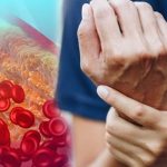 High Cholesterol: గుండె జబ్బులు రాకూడదంటే ? నిపుణుల సూచనలివే !