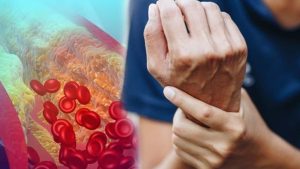 High Cholesterol: గుండె జబ్బులు రాకూడదంటే ? నిపుణుల సూచనలివే !