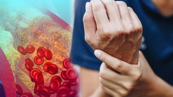 High Cholesterol: గుండె జబ్బులు రాకూడదంటే ? నిపుణుల సూచనలివే !