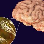 Brain Eating Amoeba: కేరళలో మెదడు తినేసే అమీబా.. 8 రోజుల్లో నలుగురు మృతి