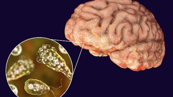 Brain Eating Amoeba: కేరళలో మెదడు తినేసే అమీబా.. 8 రోజుల్లో నలుగురు మృతి Brain Eating Amoeba: కేరళలో మెదడు తినేసే అమీబా.. 8 రోజుల్లో నలుగురు మృతి