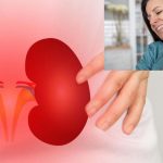 Kidney Disease: మీ ముఖం, మెడ.. ఇలా మారుతున్నట్లయితే కిడ్నీ సమస్యలు మొదలైనట్లే !