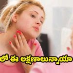 Vitamin C Deficiency: మీలో ఈ లక్షణాలున్నాయా ? అయితే జాగ్రత్త
